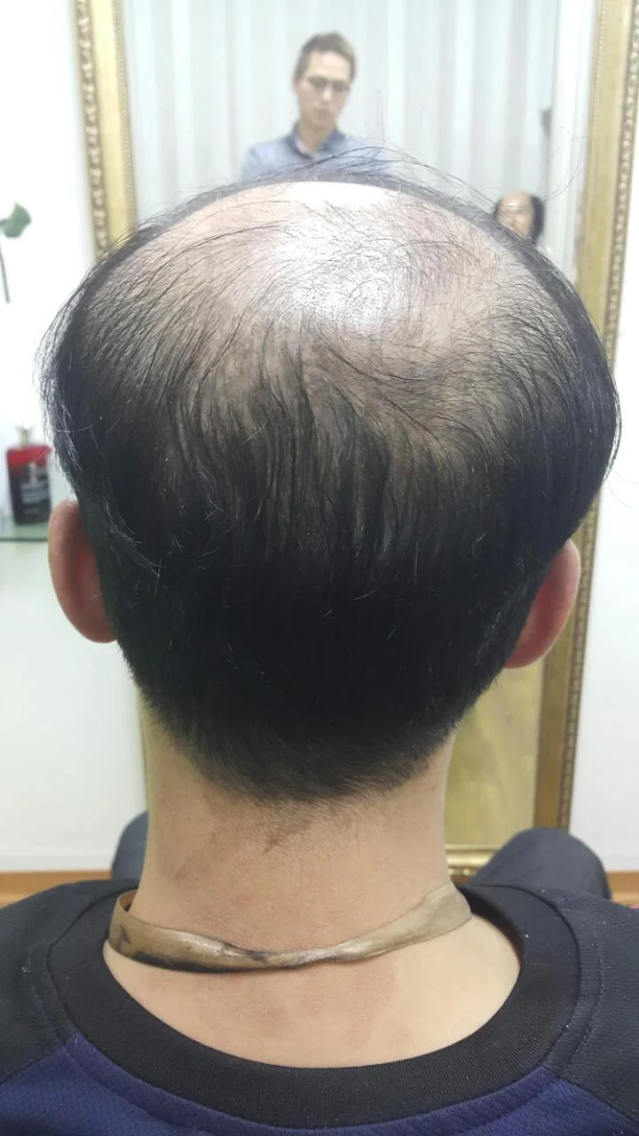 어느 각도에서도 편안하게 착용 전
