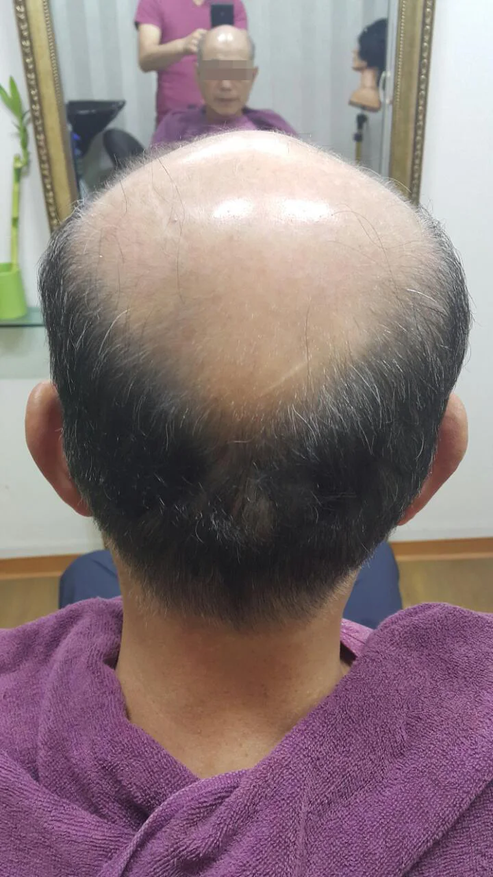 자연스러운 일상의 변화 착용 전